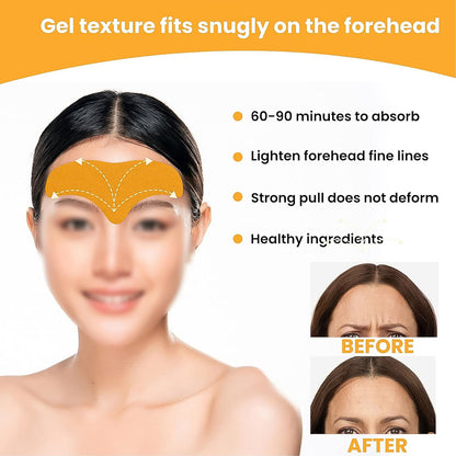 Forehead Wrinkle Patches Face Wrinkle Patches (10 Pcs Set)